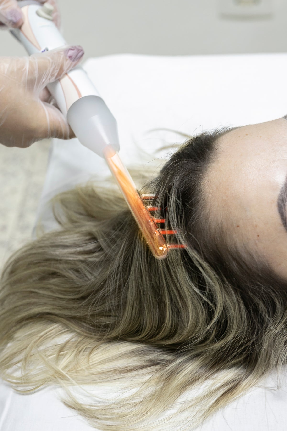 Aparelho de Alta Frequência Portátil para Tratamento Facial e Capilar – HF Ibramed