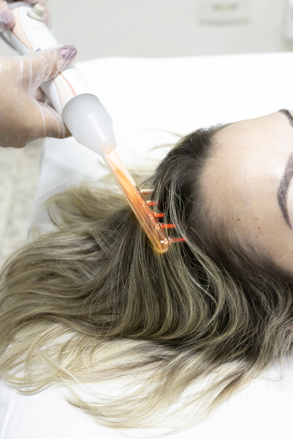 Aparelho de Alta Frequência Portátil para Tratamento Facial e Capilar – HF Ibramed